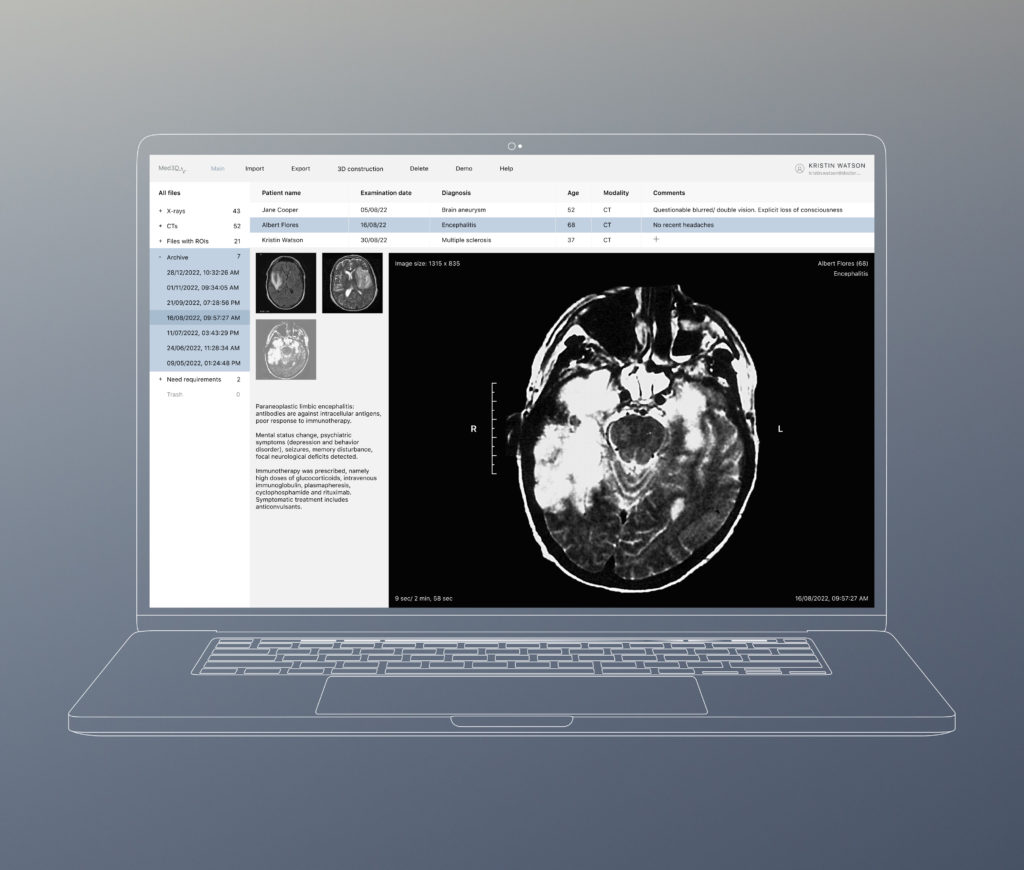 Scans Visualisation 3D